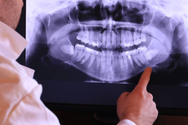 Best Broken Tooth Emergency  in Hurst, TX