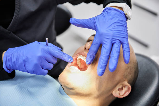 Best Chipped Tooth Repair Near Me  in Hurst, TX